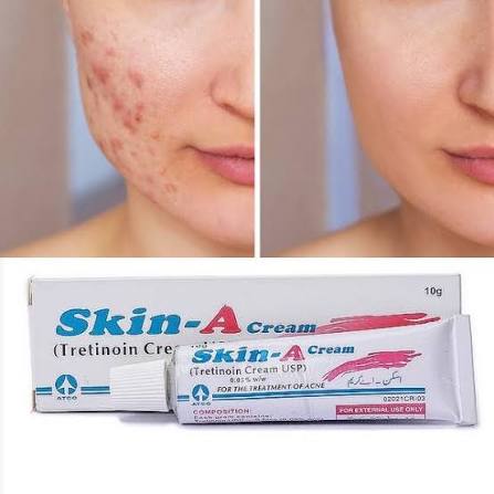 Skin-A Cream 10g